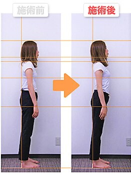 いきいき鍼灸整骨院/姿勢改善