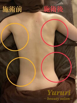 ユルリ(Yururi)/アロマリンパマッサージ