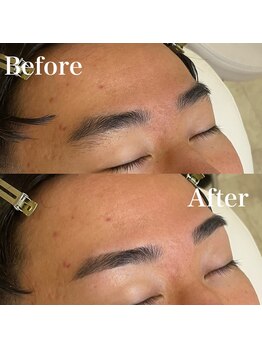 モテテ(motete)/お客様施術例☆栄本店