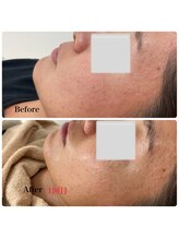 モスト(MOST)/エンビロントリートメント