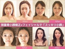 グレースフィオーレ 南越谷店(gracefiore)