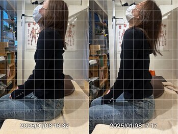 グレフル鍼灸接骨院 整体院 心斎橋/寝違え/ストレートネック/鍼