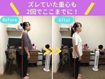 京都中丸整体カイロプラクティック/不良姿勢