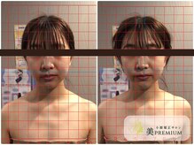 美プレミアム 越谷店/360°美顔小顔矯正｜施術結果