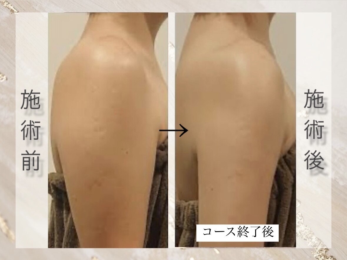 ミライ 福岡春日店(mirai)｜ホットペッパービューティー