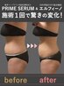 【脂肪を撃退！痩身プレミアム☆】夏までにサイズダウン♪１部位【お腹or腰】