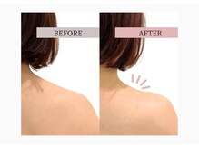 フロリール アザブジュウバン(FlorirAzabujuban)/痩身/肩こり/天使の羽