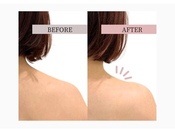 フロリール アザブジュウバン(FlorirAzabujuban)/痩身/肩こり/天使の羽