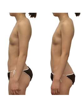 ベンザイ 梅田店(BENZAI)/産後ケアに、バストケア