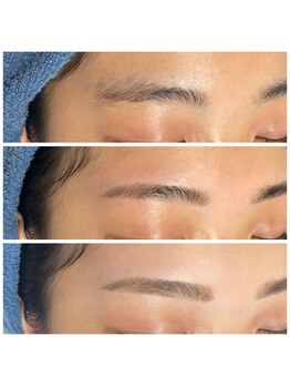 ベリル 金町店(Beryl)/お顔やパーツお悩みにも◎