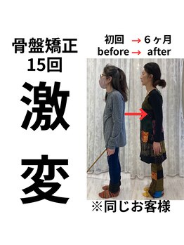 ケートータルビューティー(K. total beauty)/骨盤矯正15回、激変！（横向き）