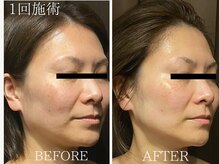 サロンドベル(salon de Belle)の雰囲気（【小顔フェイシャル】フェイスラインを綺麗にたるみ激変♪）