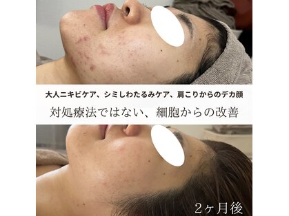 リュウ(le.lieu)の写真