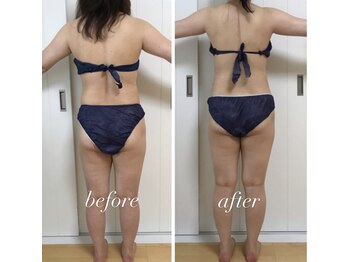 バニスティ 酒田店/カラダが軽くなり背中も綺麗に!