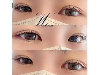 ウェリナ(welina)/
