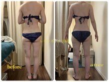 グラン ジュテの雰囲気（レモンボトルで小顔、痩身！ LDMやラジオ波と組み合わせ美bodyへ）
