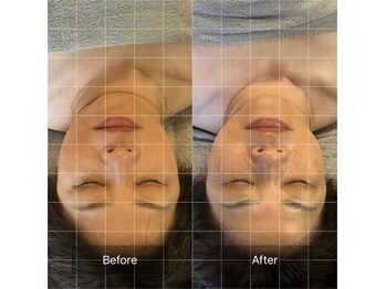 アンド ボナール(&-bonnard)