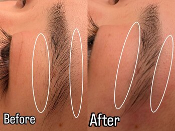 オハナ(Ohana)/美容電気脱毛デザイン眉【女性】