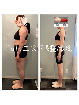 ルルエステ アンド 整体院(Lulu)/人生変わる耳つぼダイエット♪