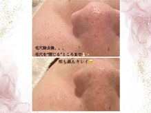 ウェリナポノビューティサロン(welina pono beauty salon)/《小顔/毛穴/脱毛》