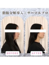 ラ セラフィータ 中目黒/【脂肪分解剤レモンボトル導入】