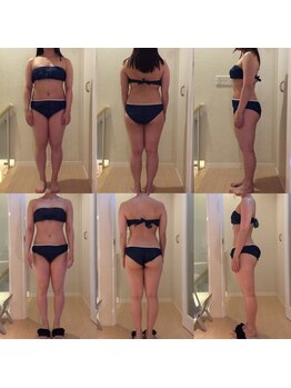 ホロニック ベルサンテ(Holonic Belle Sante)/メディセルハイブリッド