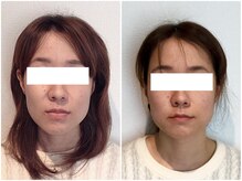 美容整体ウェリナ あま甚目寺院/小顔矯正/骨盤矯正/美脚サロン