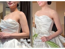 Instagramで動画♪挙式前日透明艶肌小顔最終仕上げ～本気改善