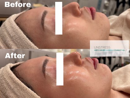 ナインオブカップス(9 of cups)の写真