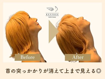 ラフリー 大阪梅田(RUFFREE)/首の可動域にも【肩甲骨はがし】