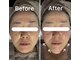 シェリー(CHERIE)の写真/年齢サインにサヨナラ!下がった顔も上向きに。効果的なリフトアップで自信を☆