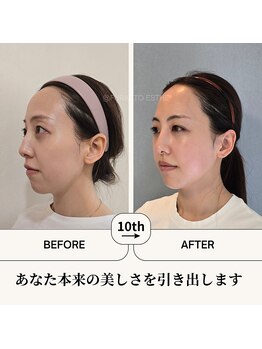 ふらっとエステ/本来の美しさを引き出します