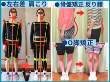 チャラク(charaku)の雰囲気（肩こり・腰痛・産後骨盤も原因を「見える化」変化多数フォトへ）