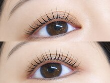 ベリス(Bellis)