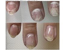 チアロ(Chiaro)の雰囲気（チビ爪さんもジェルに頼らず甘皮ケアで縦長爪に育成！）
