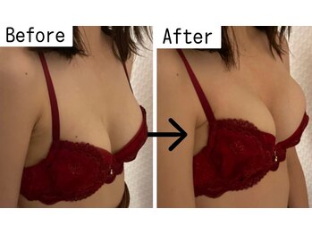 プレフィール(PLEAFEEL)/