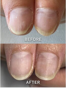 ポメロ(POMELO)/約３週間でピンクの所も伸びる