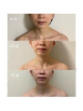 お顔の研究所/ビフォーアフター写真♪