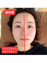 すばる整体院 小牧/小顔矯正 小牧/産後骨盤矯正