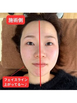 すばる整体院 小牧/小顔矯正 小牧/産後骨盤矯正