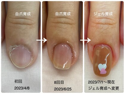 キアラネイル(Chiala nail)の写真