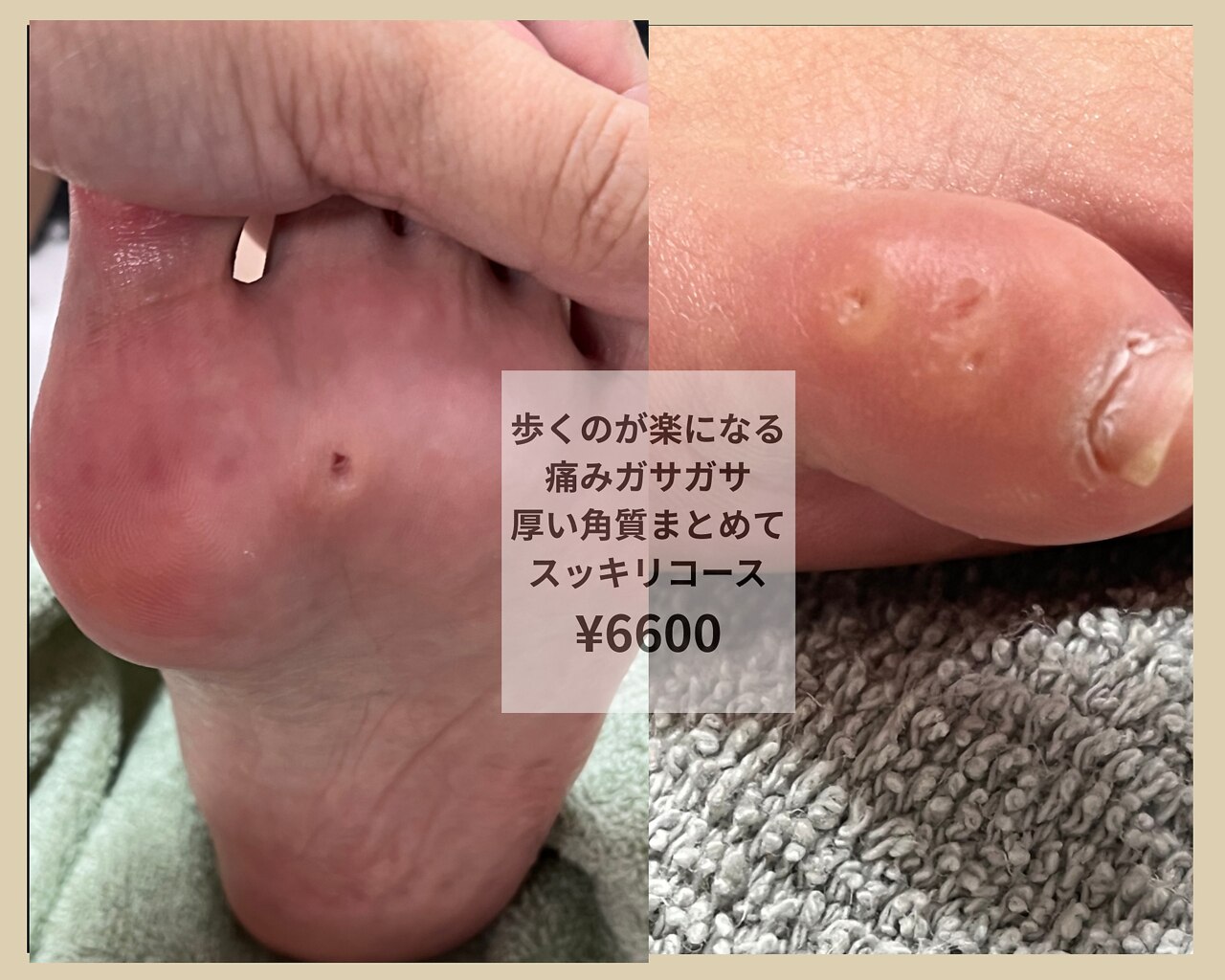爪屋 爪屋｜ホットペッパービューティー