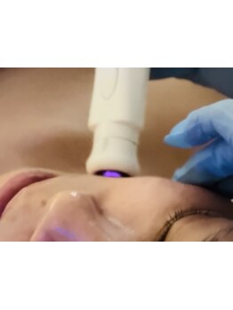 シミしわ改善！予防ケア