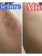 京都フォーエイチ(京都4H)/肌荒れと無縁の美肌に♪