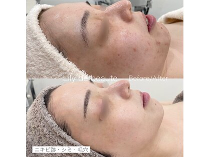 リリードボーテ 高槻店(LILY DE BEAUTE)の写真