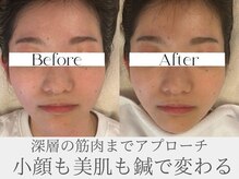 ミリグラム(mg)の雰囲気（たるみは肌の問題ではなく＼表情筋と巡り【土台】の問題です！／）