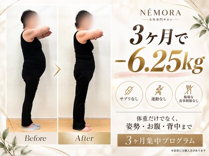 ネモラ(NE´MORA)の写真