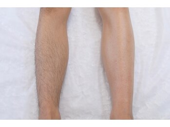 アールビューティー(R Beauty)/メンズブラジリアンワックス