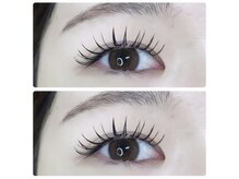 アイネ(eye:ne)/バインド×フラットMIX