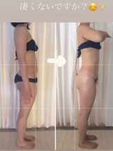 サロンドエタニティ ハピネス(salon de eternity)/お客様before after